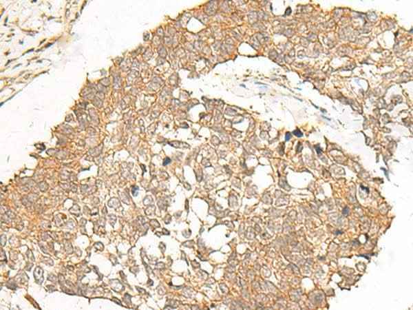 Anti-Human/Mouse POLR2L Antibody