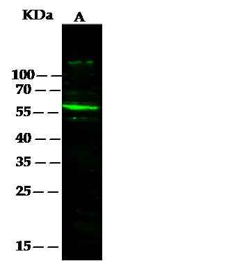 Anti-Human SerpinF2 Antibody [B236] - ABMIUM