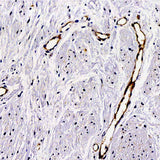 Immunohistochemistry analysis of paraffin-embedded Human hysteromyoma using VWF Polyclonal Antibody at dilution of 1:300.