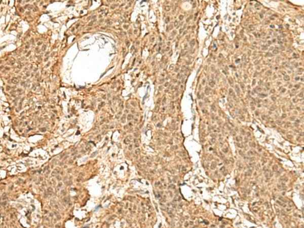 Anti-Human/Mouse/Rat TIPRL Antibody