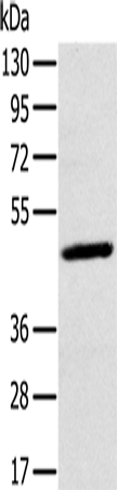 Anti-Human MAGEA10 Antibody - ABMIUM