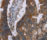 Anti-Human/Mouse CLDND1 Antibody - ABMIUM