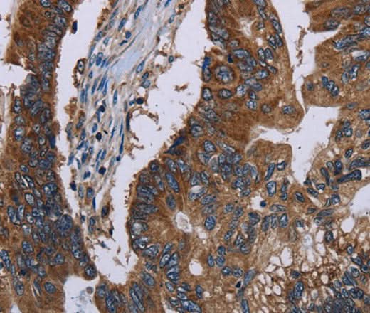 Anti-Human/Mouse CLDND1 Antibody - ABMIUM