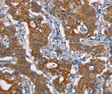 Anti-Human/Mouse CDC23 Antibody - ABMIUM