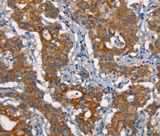 Anti-Human/Mouse CDC23 Antibody - ABMIUM