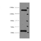 Western Blot analysis of Hela cells using CD45 Monoclonal Antibody at dilution of 1:2000.