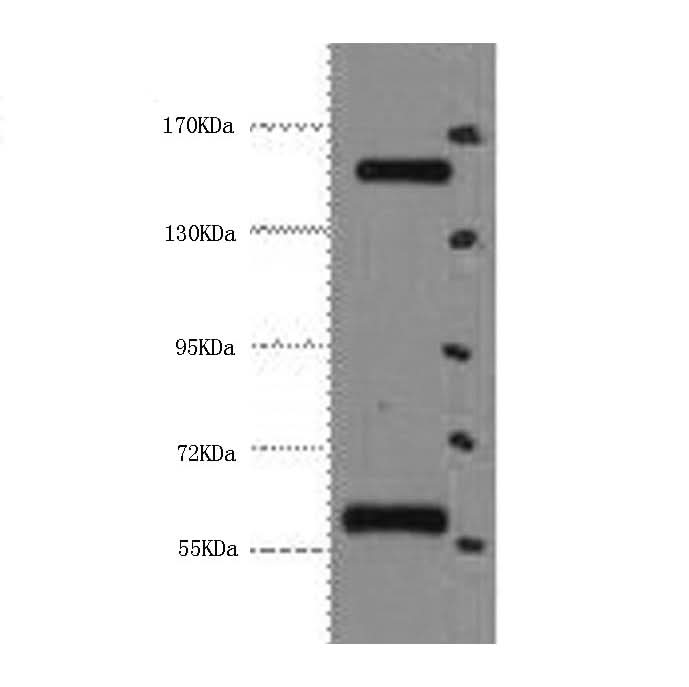 Western Blot analysis of Hela cells using CD45 Monoclonal Antibody at dilution of 1:2000.