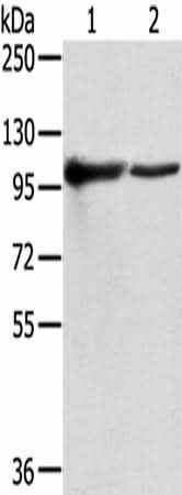 Anti-Human/Mouse TPX2 Antibody