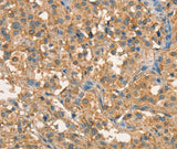 Anti-Human/Mouse/Rat CRELD1 Antibody - ABMIUM
