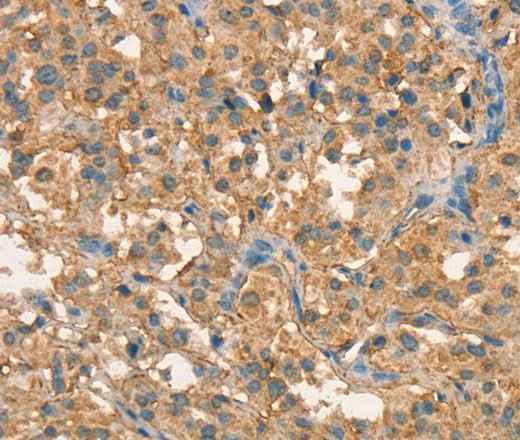Anti-Human/Mouse/Rat CRELD1 Antibody