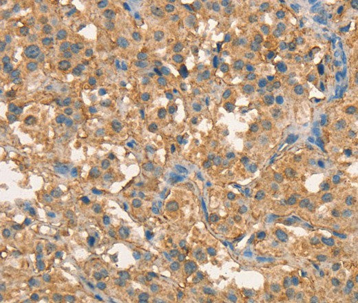 Anti-Human/Mouse/Rat CRELD1 Antibody - ABMIUM