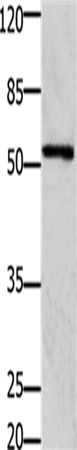 Anti-Human/Mouse/Rat GFRA1 Antibody - ABMIUM