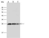 Anti-Human GSTP1 Antibody [A1240] - ABMIUM