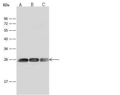 Anti-Human GSTP1 Antibody [A1240] - ABMIUM