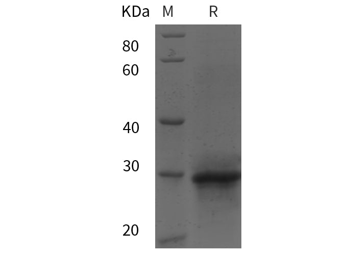 SDS-PAGE analysis of Human Ras-related proteins, 2 μg/lane of Recombinant Human Ras-related proteins was resolved with SDS-PAGE under reducing conditions, showing bands at 31 kDa.
