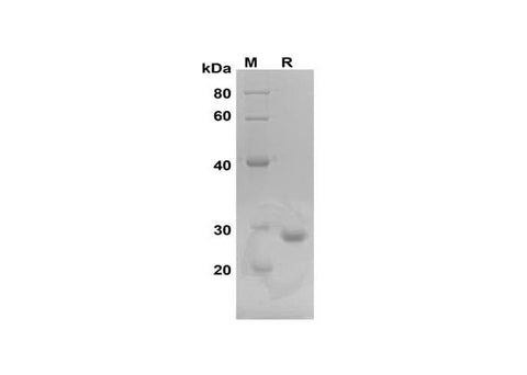 SDS-PAGE analysis of Rat IL-6 proteins, 2 μg/lane of Recombinant Rat IL-6 proteins was resolved with SDS-PAGE under reducing conditions, showing bands at 28 kDa.