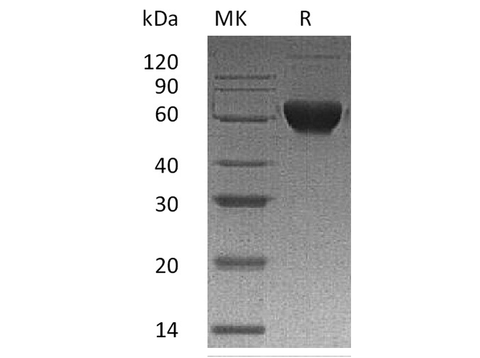 Recombinant Human Activin Receptor 2B/ACVR2B Protein (Fc & His Tag) - ABMIUM