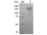 Recombinant SARS-CoV-2 S1 Protein (mFc Tag) - ABMIUM