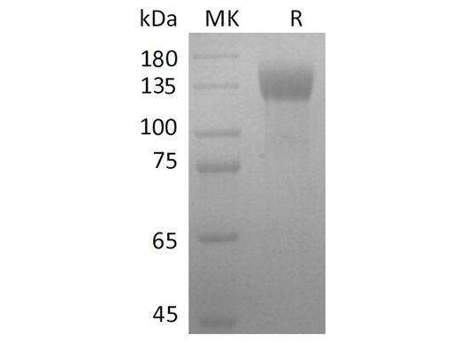 Recombinant SARS-CoV-2 S1 Protein (mFc Tag) - ABMIUM