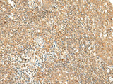 Immunohistochemistry of paraffin-embedded Human tonsil tissue using GPR89A/GPR89B Polyclonal Antibody at dilution of 1:25(×200)