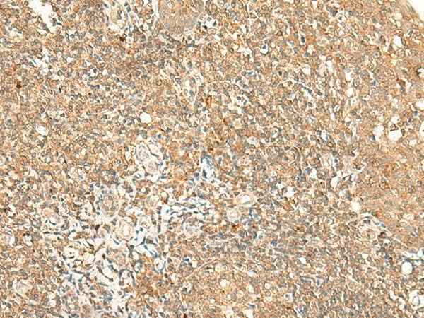 Anti-Human/Mouse GPR89A/GPR89B Antibody