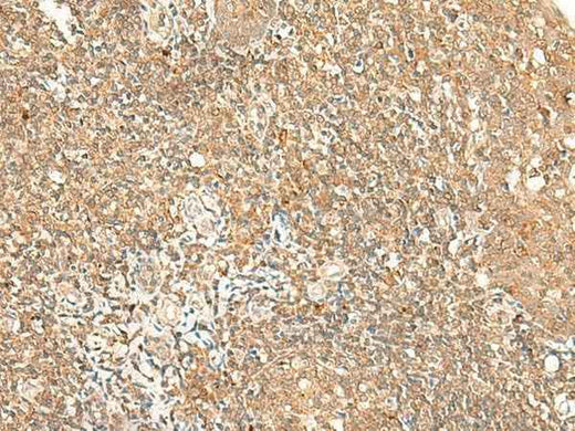 Anti-Human/Mouse GPR89A/GPR89B Antibody