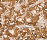 Anti-Human/Mouse/Rat RBBP8 Antibody - ABMIUM