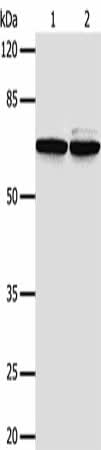 Anti-Human/Mouse PIF1 Antibody - ABMIUM
