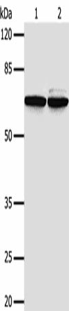 Anti-Human/Mouse PIF1 Antibody - ABMIUM