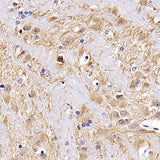 Immunohistochemistry analysis of paraffin-embedded mouse brain using MAP2 Polyclonal Antibody at dilution of 1:300.