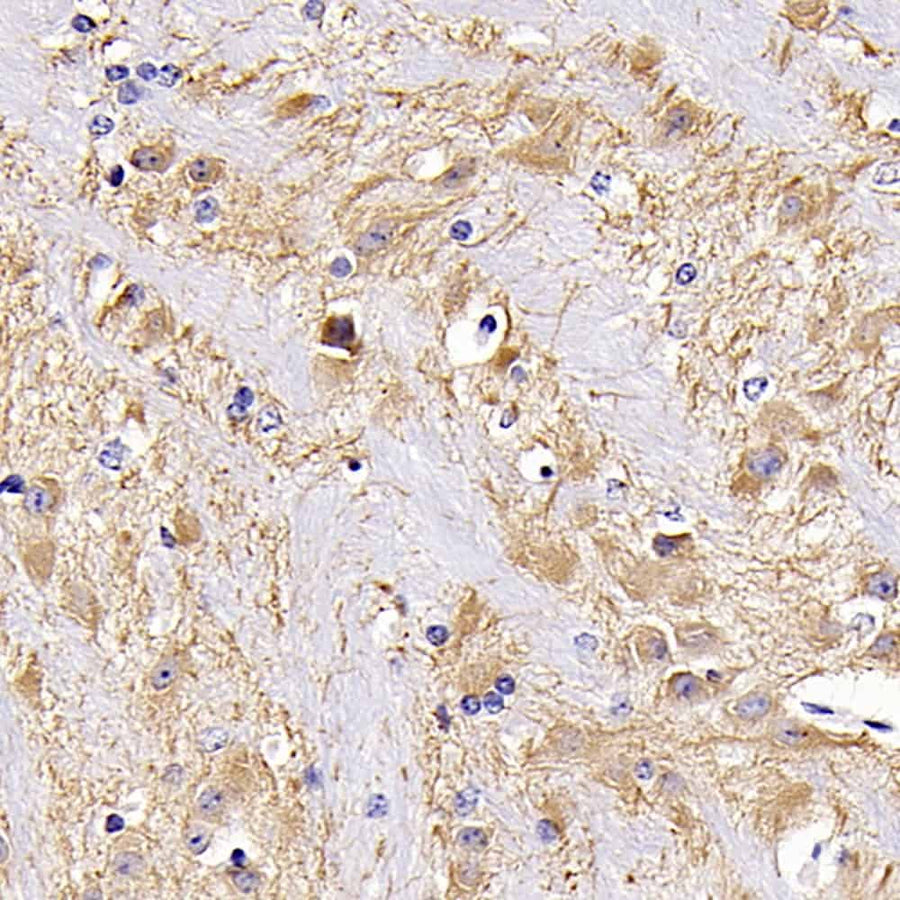 Immunohistochemistry analysis of paraffin-embedded mouse brain using MAP2 Polyclonal Antibody at dilution of 1:300.