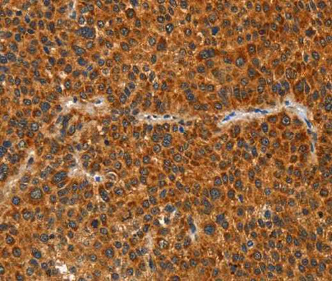 Anti-Human/Mouse IKZF3 Antibody