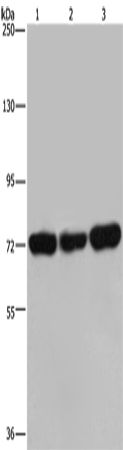 Anti-Human/Mouse PCK2 Antibody - ABMIUM
