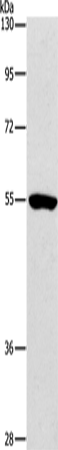 Anti-Human/Mouse/Rat ANGPT2 Antibody - ABMIUM