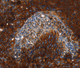 Anti-Human MSLN Antibody - ABMIUM