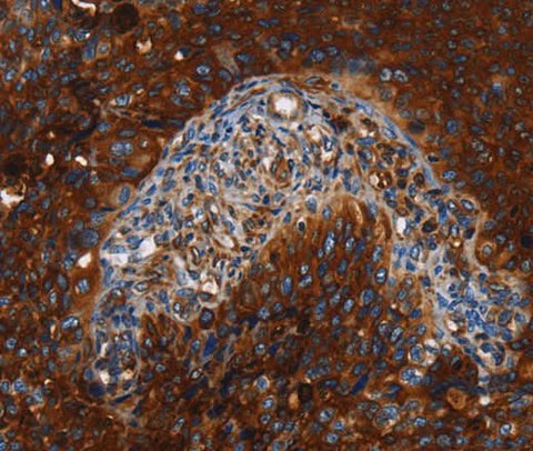 Anti-Human MSLN Antibody - ABMIUM