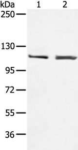 Anti-Human TERT Antibody - ABMIUM