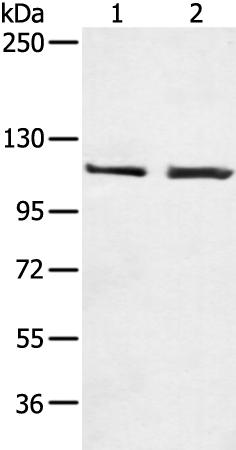 Anti-Human TERT Antibody - ABMIUM