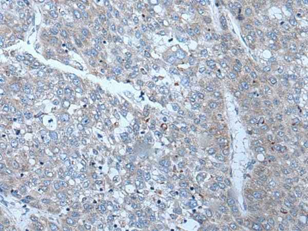 Anti-Human SLC24A5 Antibody
