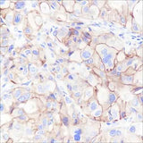 Anti-Human/Mouse CD47 Antibody [A175]