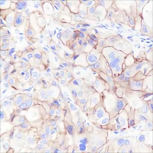 Anti-Human/Mouse CD47 Antibody [A175] - ABMIUM