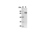SDS-PAGE analysis of Human CD200 proteins, 2 μg/lane of Recombinant Human CD200 proteins was resolved with SDS-PAGE under reducing conditions, showing bands at 47.1 kDa.