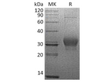 Recombinant Human CSN3/CASK Protein (His Tag) - ABMIUM