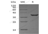 Recombinant Human Cyclophilin E/PPIE Protein (His Tag) - ABMIUM