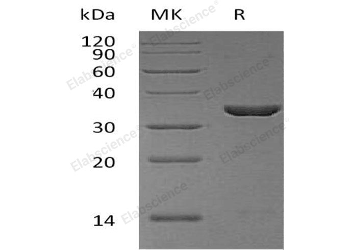 Recombinant Human Cyclophilin E/PPIE Protein (His Tag) - ABMIUM