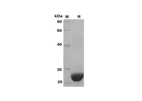 SDS-PAGE analysis of Human CXCL1 proteins, 2 μg/lane of Recombinant Human CXCL1 proteins was resolved with SDS-PAGE under reducing conditions, showing bands at 25 kDa.