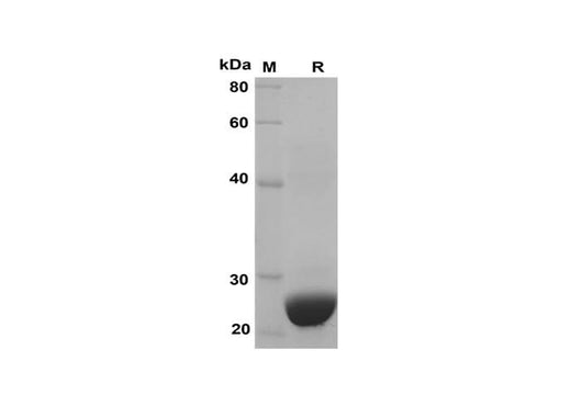 SDS-PAGE analysis of Human CXCL1 proteins, 2 μg/lane of Recombinant Human CXCL1 proteins was resolved with SDS-PAGE under reducing conditions, showing bands at 25 kDa.