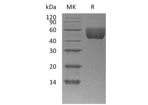 Recombinant Mouse CD147/Basigin Protein (aa 22-325, His Tag) - ABMIUM