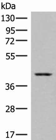 Anti-Human/Mouse/Rat DHPS Antibody