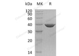 Recombinant Human Transaldolase/TALDO1 Protein (His Tag) - ABMIUM